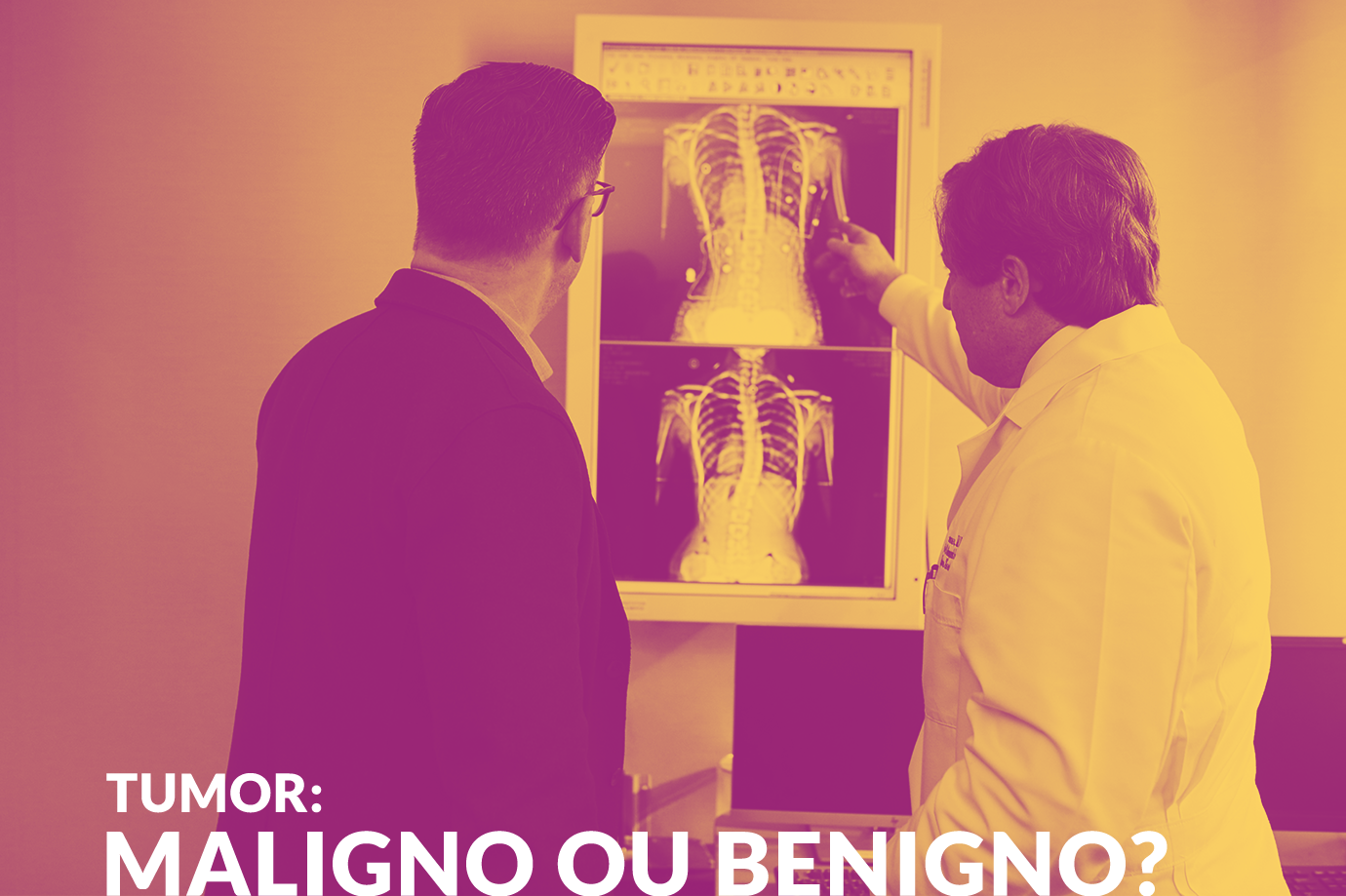 Tumor: maligno ou benigno?