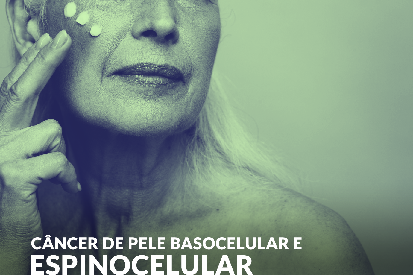 Câncer de Pele Basocelular e Espinocelular