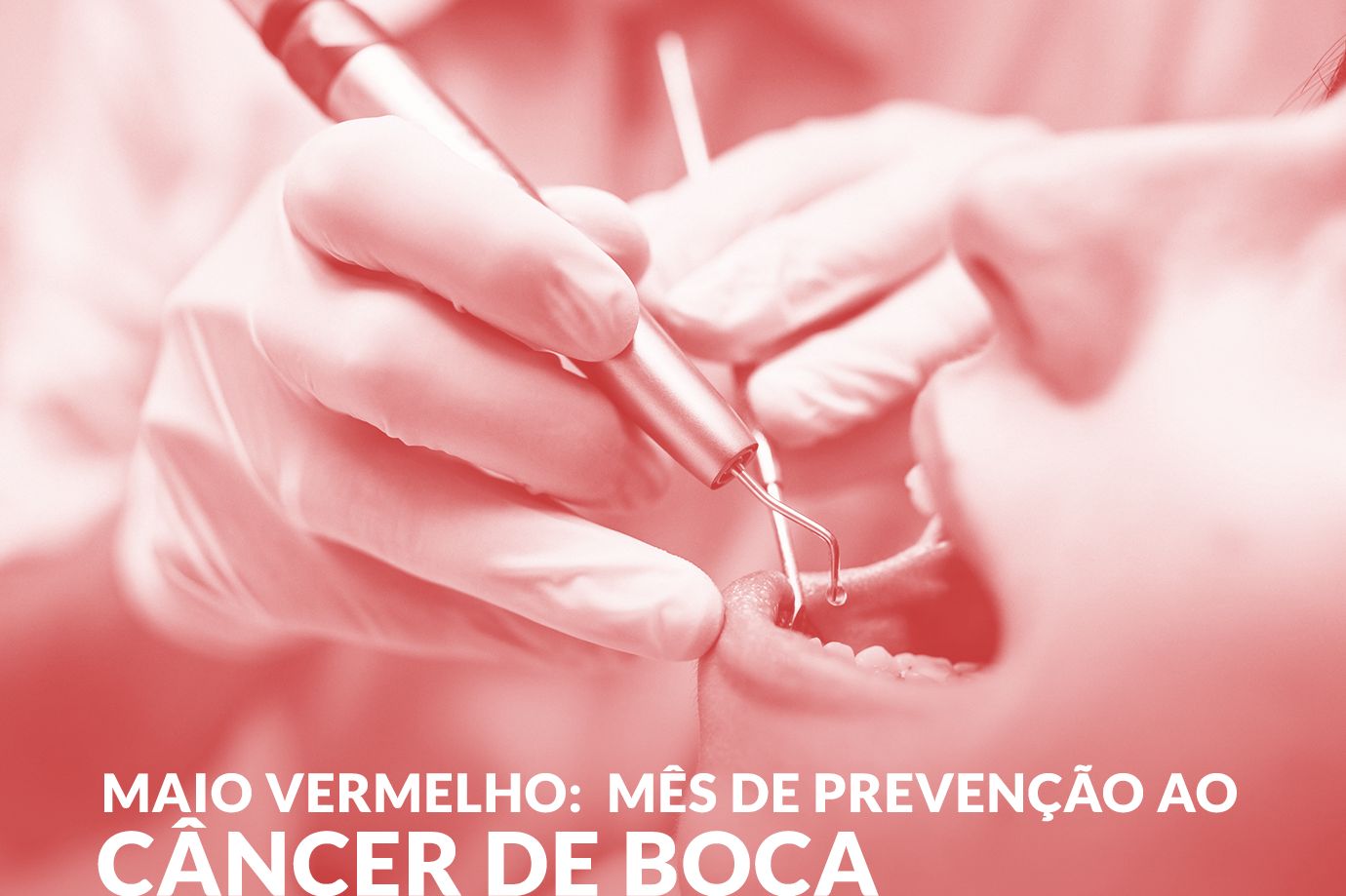 Maio Vermelho: Mês de prevenção ao câncer de boca