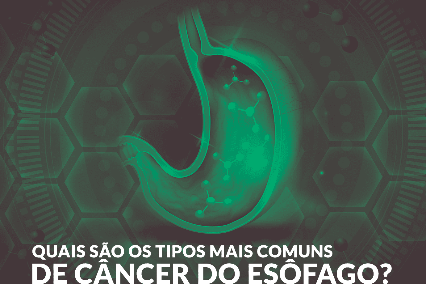 Quais são os tipos mais comuns de câncer do esôfago?