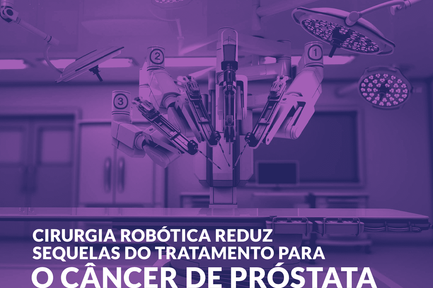 Cirurgia robótica reduz sequelas do tratamento para o câncer de próstata