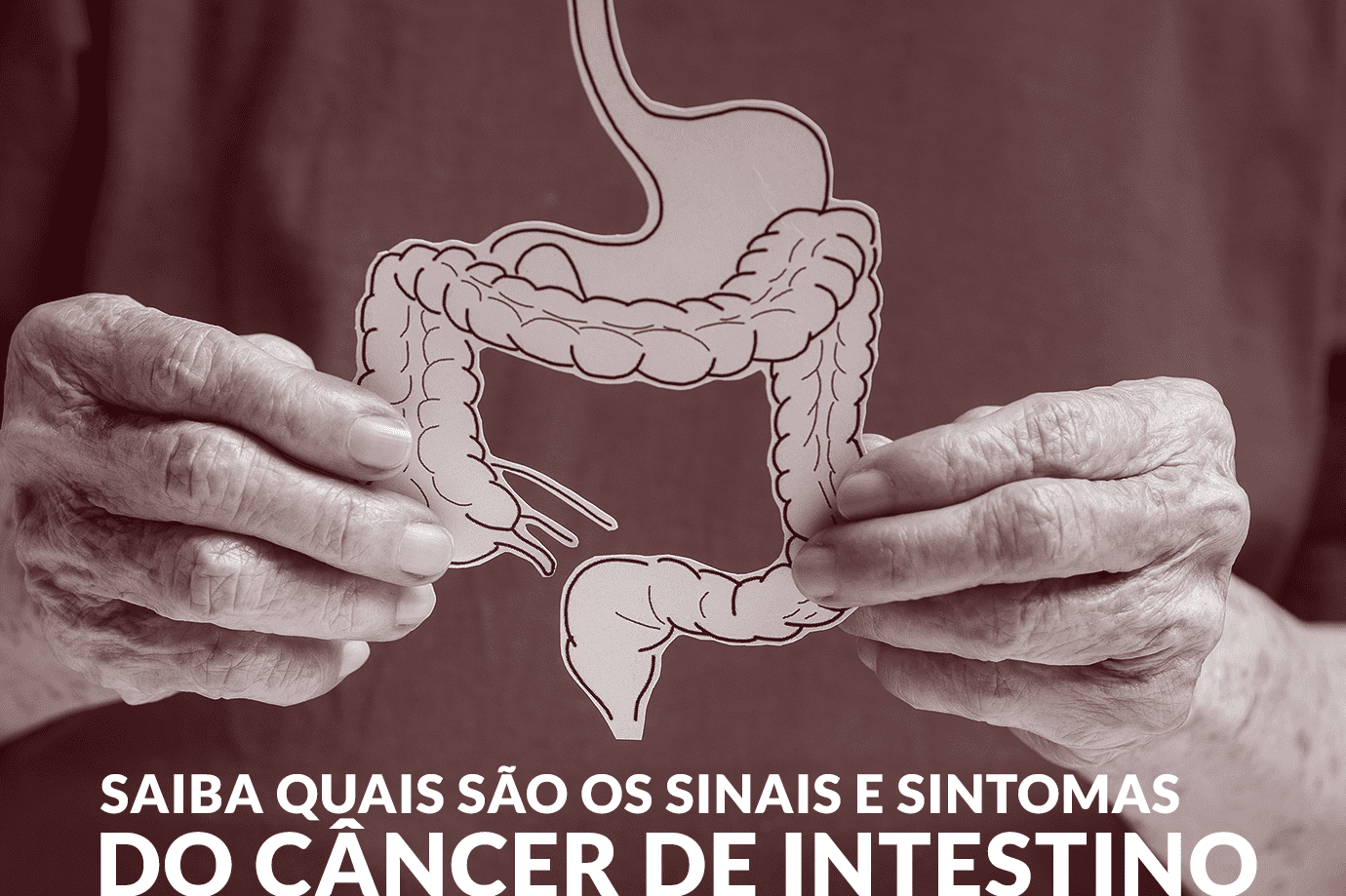 Saiba quais são os sinais e sintomas do câncer de intestino