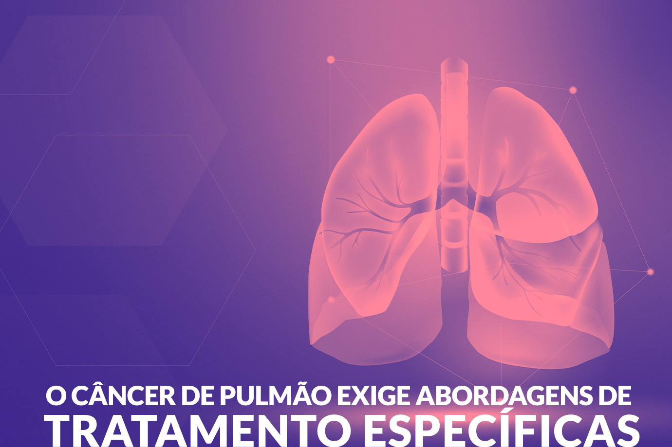 O Câncer de Pulmão exige abordagens de tratamento específicas